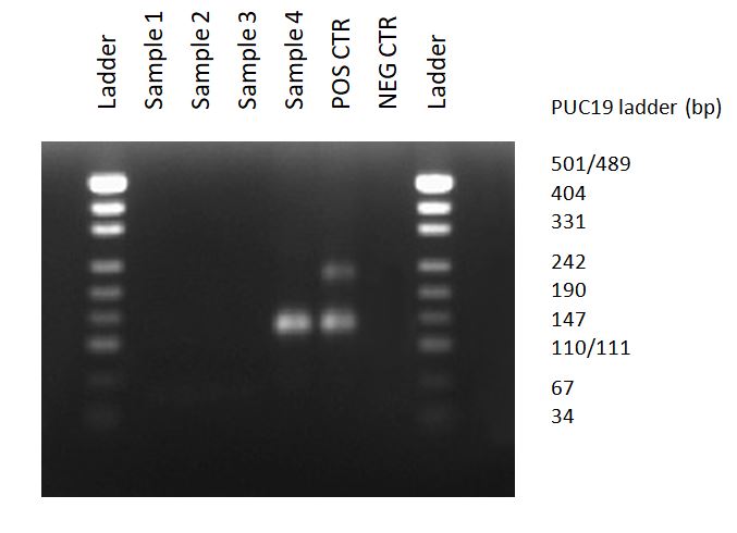 Agarose gel electrophoresis, after PCR with MycoDiag assays, allows to observe bands between 121 to 230 bp, in case of Mycoplasma contamination of cell culture supernatants.