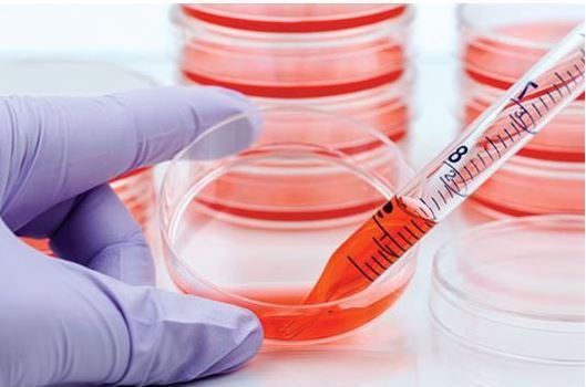 Reliable mycoplasma detection with AnyGenes® MycoDiag® qPCR assays