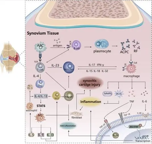 Inflammation ana autoimmunity in the pathogenesis of rheumatoid arthritis
