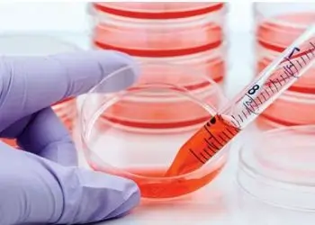 MycoDiag assays ensure a fast and reliable screening of your cell culture supernatants for Mycoplasma contamination by qPCR or PCR .
