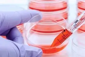 AnyGenes® Mycoplasma detection qPCR array